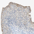 Immunohistochemical staining of human urinary bladder shows weak to moderate cytoplasmic positivity in urothelial cells.