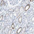 Anti-BPGM Antibody