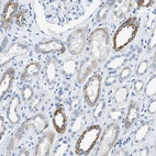 Immunohistochemical staining of human kidney shows weak to moderate cytoplasmic positivity in cells in tubules.