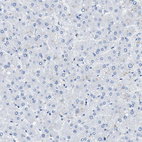 Immunohistochemical staining of human liver shows no positivity in hepatocytes as expected.