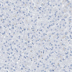 Anti-BPGM Antibody