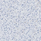 Immunohistochemical staining of human liver shows no positivity in hepatocytes as expected.