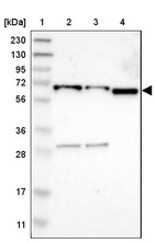 Lane 1: Marker [kDa] 230, 130, 95, 72, 56, 36, 28, 17, 11_br/_Lane 2: Human cell line RT-4_br/_Lane 3: Human cell line U-251MG sp_br/_Lane 4: Human plasma (IgG/HSA depleted)