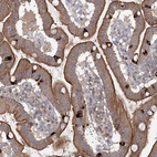 Anti-MAP3K13 Antibody