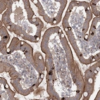 Anti-MAP3K13 Antibody