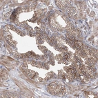 Immunohistochemical staining of human prostate shows strong membranous positivity in glandular cells.