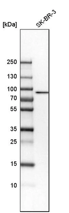 Western blot analysis in human cell line SK-BR-3.