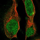 Immunofluorescent staining of human cell line U-2 OS shows localization to nucleoplasm, cytosol & microtubule organizing center.