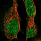 Immunofluorescent staining of human cell line U-2 OS shows localization to nucleoplasm, cytosol & microtubule organizing center.
