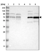 Lane 1: Marker [kDa] 230, 130, 95, 72, 56, 36, 28, 17, 11_br/_Lane 2: Human cell line RT-4_br/_Lane 3: Human cell line U-251MG sp_br/_Lane 4: Human plasma (IgG/HSA depleted)_br/_Lane 5: Human liver tissue_br/_Lane 6: Human tonsil tissue