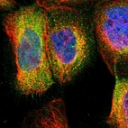 Immunofluorescent staining of human cell line A-431 shows localization to cytosol.
