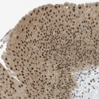 Anti-ARID1B Antibody