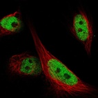 Immunofluorescent staining of human cell line U-251 MG shows localization to nucleoplasm.