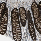 Immunohistochemical staining of human colon shows strong cytoplasmic positivity in glandular cells.