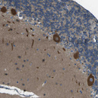 Immunohistochemical staining of human cerebellum shows strong cytoplasmic positivity in Purkinje cells.