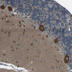 Immunohistochemical staining of human cerebellum shows strong cytoplasmic positivity in Purkinje cells.