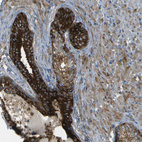 Immunohistochemical staining of human prostate shows strong cytoplasmic positivity in glandular cells.