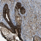 Immunohistochemical staining of human prostate shows strong cytoplasmic positivity in glandular cells.