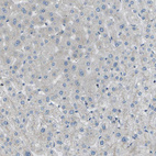 Immunohistochemical staining of human liver shows no positivity in hepatocytes as expected.