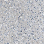 Immunohistochemical staining of human liver shows no positivity in hepatocytes as expected.