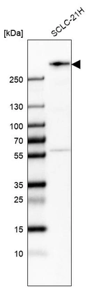 Western blot analysis in human cell line SCLC-21H.