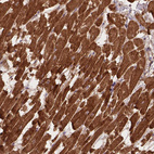 Immunohistochemical staining of human Heart muscle shows strong cytoplasmic positivity in cardiomyocytes.