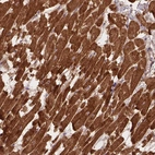 Immunohistochemical staining of human Heart muscle shows strong cytoplasmic positivity in cardiomyocytes.