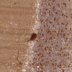 Immunohistochemical staining of human Cerebellum shows strong cytoplasmic positivity in Purkinje cells.