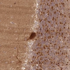 Immunohistochemical staining of human Cerebellum shows strong cytoplasmic positivity in Purkinje cells.