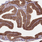 Immunohistochemical staining of human Fallopian tube shows moderate membranous positivity in glandular cells.