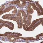 Immunohistochemical staining of human Fallopian tube shows moderate membranous positivity in glandular cells.