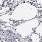 Immunohistochemical staining of human lung shows moderate to strong cytoplasmic positivity in macrophages.
