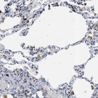 Immunohistochemical staining of human lung shows moderate to strong cytoplasmic positivity in macrophages.