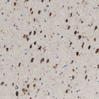 Immunohistochemical staining of human cerebral cortex shows moderate to strong cytoplasmic positivity in neuronal cells.