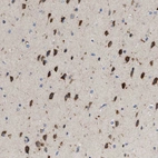 Immunohistochemical staining of human cerebral cortex shows moderate to strong cytoplasmic positivity in neuronal cells.