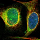 Immunofluorescent staining of human cell line U-2 OS shows localization to endoplasmic reticulum.