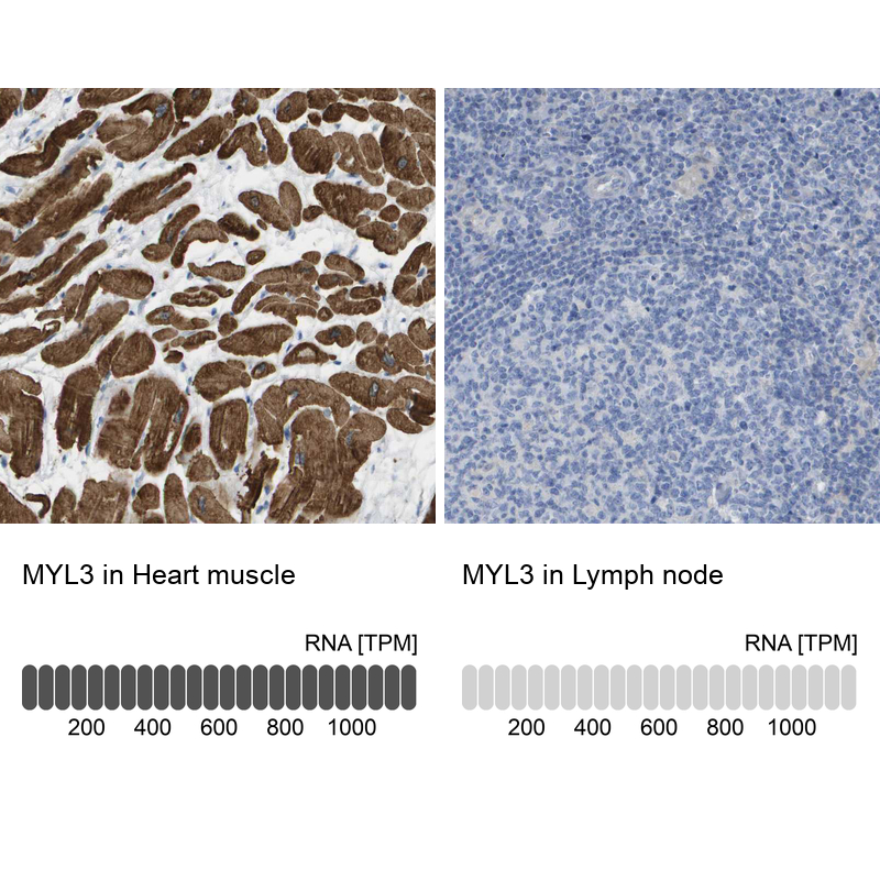 Anti-MYL3 Antibody