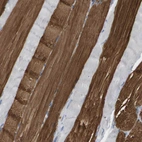 Immunohistochemical staining of human skeletal muscle shows moderate to strong cytoplasmic positivity in myocytes.