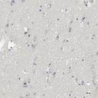 Immunohistochemical staining of human cerebral cortex shows no positivity in neurons as expected.