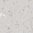 Anti-MYL3 Antibody