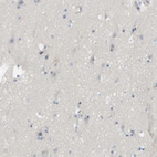 Immunohistochemical staining of human cerebral cortex shows no positivity in neurons as expected.
