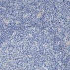 Immunohistochemical staining of human lymph node shows no positivity in non-germinal center cells as expected.