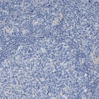 Immunohistochemical staining of human lymph node shows no positivity in non-germinal center cells as expected.