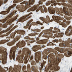 Immunohistochemical staining of human heart muscle shows moderate to strong cytoplasmic positivity in cardiomyocytes.
