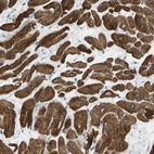 Anti-MYL3 Antibody