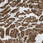 Immunohistochemical staining of human heart muscle shows moderate to strong cytoplasmic positivity in cardiomyocytes.