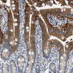 Anti-SLC35E1 Antibody