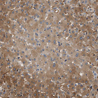 Anti-SLC35E1 Antibody