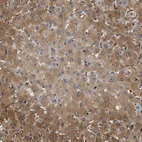 Immunohistochemical staining of human liver shows moderate cytoplasmic positivity in hepatocytes.