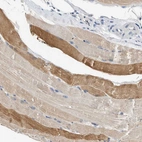 Immunohistochemical staining of human skeletal muscle shows weak to moderate cytoplasmic positivity in myocytes.